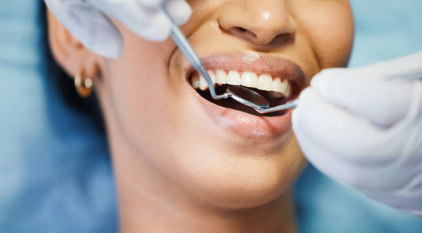 Best Emergency Dentist for Knocked-Out Tooth in Baywood, NY